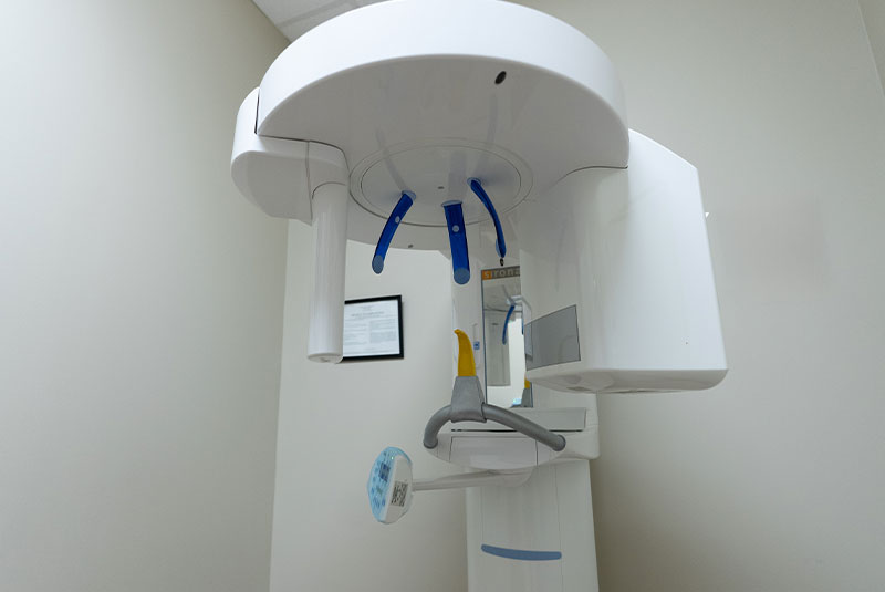 cbct
