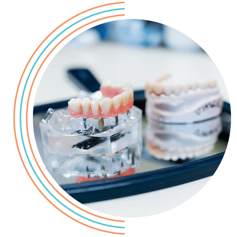 full arch models on mirror