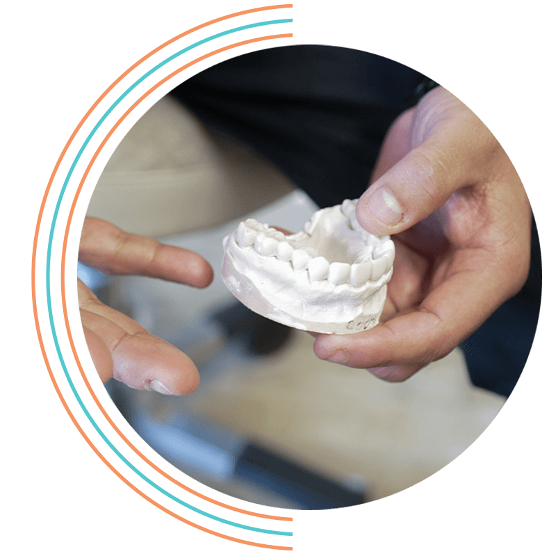 full arch model being explained