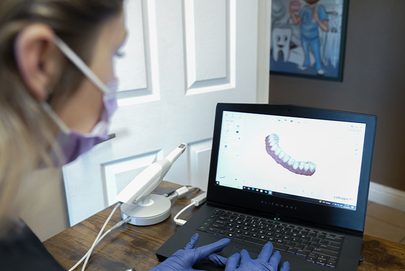 tech being used digital dental scan 3d