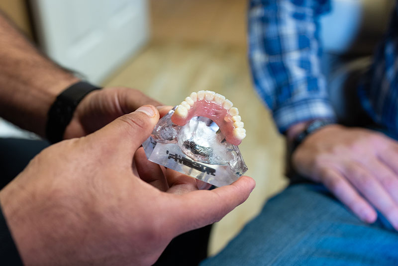 full arch model in hand of dr norwood